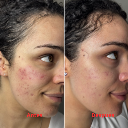 AuraSkin 7D Pro™ | Aesthetic Clinic Results at Home
