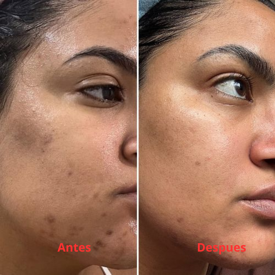 AuraSkin 7D Pro™ | Aesthetic Clinic Results at Home