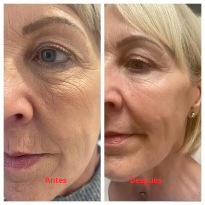AuraSkin 7D Pro™ | Aesthetic Clinic Results at Home