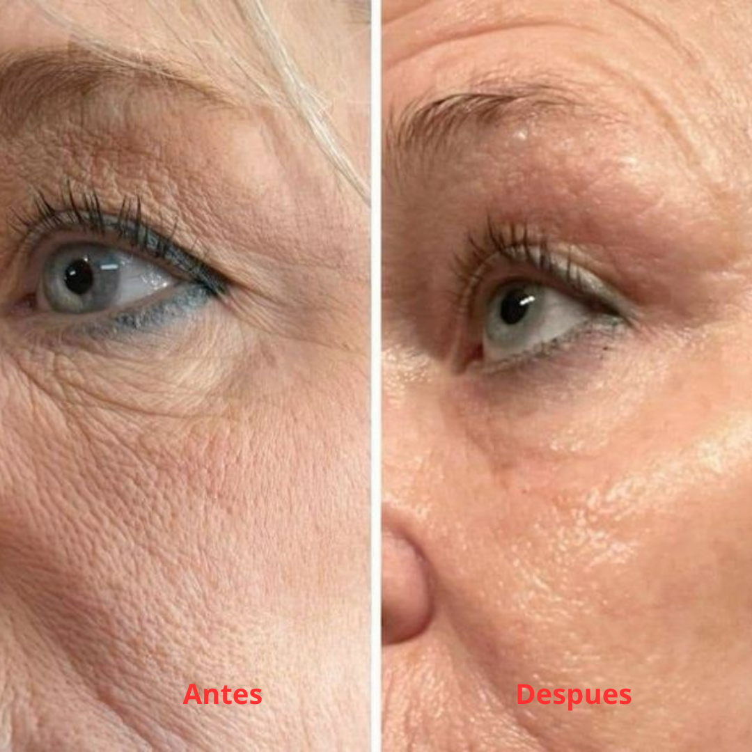 AuraSkin 7D Pro™ | Aesthetic Clinic Results at Home