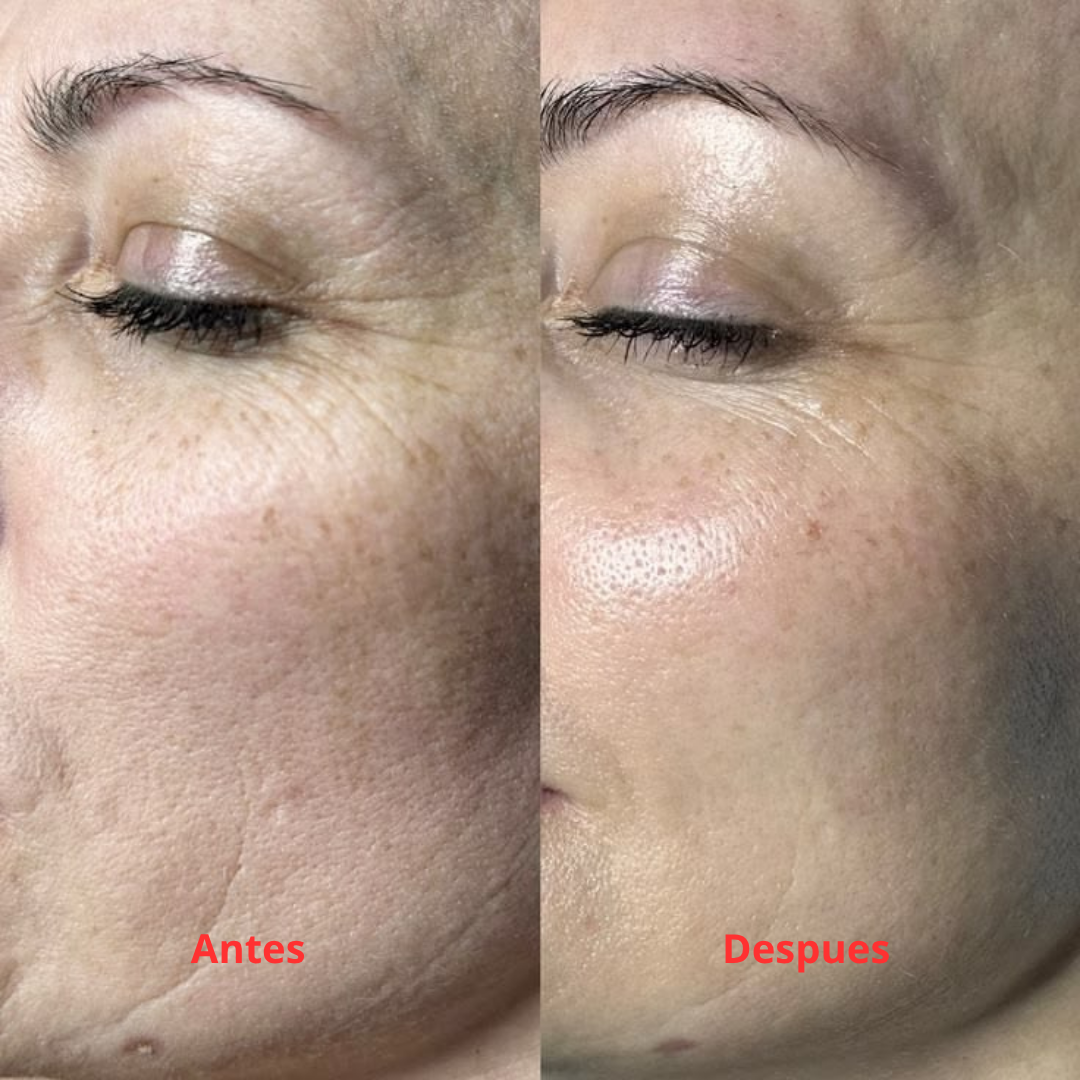 AuraSkin 7D Pro™ | Aesthetic Clinic Results at Home