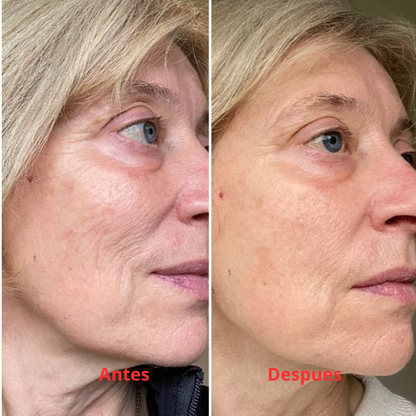 AuraSkin 7D Pro™ | Aesthetic Clinic Results at Home