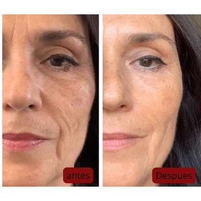 Seorya® Dragon Blood – The ancient ritual already used by 2,000+ women for porcelain skin.